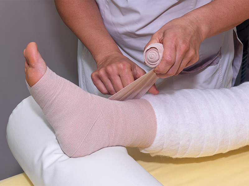 Kompressionstherapie in Mainz mit Bandagierung des Beins zur Behandlung von Lymphödemen und Unterstützung des venösen und lymphatischen Abflusses.